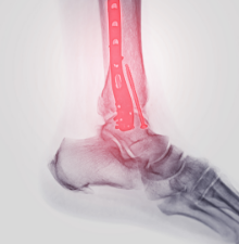 인공신장 사진2